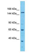 EFCAB5 Antibody - EFCAB5 antibody Western Blot of ACHN. Antibody dilution: 1 ug/ml.  This image was taken for the unconjugated form of this product. Other forms have not been tested.