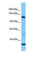 EFCAB6 Antibody - Western blot of EFCAB6 Antibody with human OVCAR-3 Whole Cell lysate.  This image was taken for the unconjugated form of this product. Other forms have not been tested.