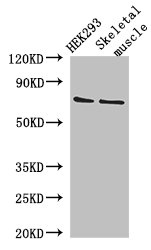 EFCAB7 Antibody - Western Blot Positive WB detected in:HEK293 whole cell lysate,Mouse skletal muscle tissue All Lanes: EFCAB7 antibody at 2.8ug/ml Secondary Goat polyclonal to rabbit IgG at 1/50000 dilution Predicted band size: 72,70 kDa Observed band size: 72 kDa