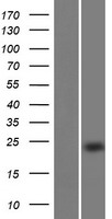 EFCAB9 Protein - Western validation with an anti-DDK antibody * L: Control HEK293 lysate R: Over-expression lysate