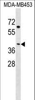 EFCBP2 / NECAB2 Antibody - NECAB2 Antibody western blot of MDA-MB453 cell line lysates (35 ug/lane). The NECAB2 antibody detected the NECAB2 protein (arrow).
