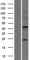 EFCBP2 / NECAB2 Protein - Western validation with an anti-DDK antibody * L: Control HEK293 lysate R: Over-expression lysate
