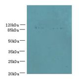 EFHB Antibody - Western blot. All lanes: EFHB antibody at 4 ug/ml. Lane 1: HepG-2 whole cell lysate. Lane 2: PC-3 whole cell lysate. Lane 3: A549 whole cell lysate. Secondary antibody: Goat polyclonal to Rabbit IgG at 1:10000 dilution. Predicted band size: 94 kDa. Observed band size: 94 kDa.