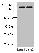 EFHB Antibody - Western blot All lanes: EFHB antibody at 4µg/ml Lane 1: HepG2 whole cell lysate Lane 2: PC-3 whole cell lysate Lane 3: A549 whole cell lysate Secondary Goat polyclonal to rabbit IgG at 1/10000 dilution Predicted band size: 94, 71, 80 kDa Observed band size: 94 kDa