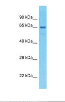 EFHC1 Antibody - Western blot of Human large intestine Tumor. EFHC1 antibody dilution 1.0 ug/ml.  This image was taken for the unconjugated form of this product. Other forms have not been tested.