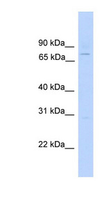 EFHC1 Antibody - EFHC1 antibody Western blot of Fetal Kidney lysate. This image was taken for the unconjugated form of this product. Other forms have not been tested.