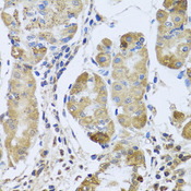 EFHC1 Antibody - Immunohistochemistry of paraffin-embedded human stomach tissue.