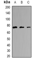 EFHC1 Antibody - Western blot analysis of EFHC1 expression in HeLa (A); mouse testis (B); mouse brain (C) whole cell lysates.