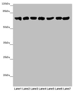 EFHC1 Antibody - Western blot All Lanes: EFHC1 antibody at 9.9 ug/ml Lane 1: Mouse large intestine tissue Lane 2: Mouse stomach tissue Lane 3: Mouse brain tissue Lane 4: Mouse kidney tissue Lane 5: Mouse gonadal tissue Lane 6: Hela whole cell lysate Lane 7: 293T whole cell lysate Secondary Goat polyclonal to rabbit IgG at 1/10000 dilution Predicted band size: 74,32,73 kDa Observed band size: 74 kDa