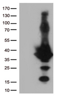 EFHD1 Antibody - HEK293T cells were transfected with the pCMV6-ENTRY control. (Left lane) or pCMV6-ENTRY EFHD1. (Right lane) cDNA for 48 hrs and lysed. Equivalent amounts of cell lysates. (5 ug per lane) were separated by SDS-PAGE and immunoblotted with anti-EFHD1. (1:2000)
