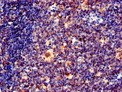 EFHD2 Antibody - Immunohistochemistry of paraffin-embedded human tonsil tissue at dilution of 1:100