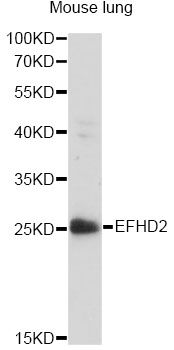 EFHD2 Antibody - Western blot analysis of extracts of mouse lung, using EFHD2 antibody at 1:1000 dilution. The secondary antibody used was an HRP Goat Anti-Rabbit IgG (H+L) at 1:10000 dilution. Lysates were loaded 25ug per lane and 3% nonfat dry milk in TBST was used for blocking. An ECL Kit was used for detection and the exposure time was 90s.