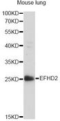 EFHD2 Antibody - Western blot analysis of extracts of mouse lung, using EFHD2 antibody at 1:1000 dilution. The secondary antibody used was an HRP Goat Anti-Rabbit IgG (H+L) at 1:10000 dilution. Lysates were loaded 25ug per lane and 3% nonfat dry milk in TBST was used for blocking. An ECL Kit was used for detection and the exposure time was 90s.