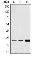 EFNA1 / Ephrin A1 Antibody - Western blot analysis of Ephrin A1 expression in THP1 (A); HUVEC (B); MCF7 (C) whole cell lysates.