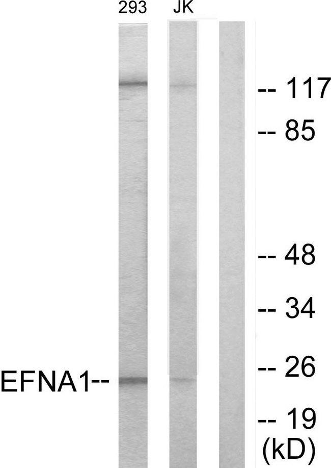 EFNA1 / Ephrin A1 Antibody - Western blot analysis of extracts from 293 cells and Jurkat cells, using EFNA1 antibody.