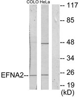 EFNA2 / Ephrin A2 Antibody - Western blot analysis of lysates from HeLa and COLO205 cells, using EFNA2 Antibody. The lane on the right is blocked with the synthesized peptide.