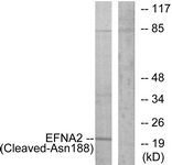 EFNA2 / Ephrin A2 Antibody - Western blot of extracts from 293 cells, treated with etoposide 25 uM 1h, using EFNA2 (Cleaved-Asn188) Antibody. The lane on the right is treated with the synthesized peptide.
