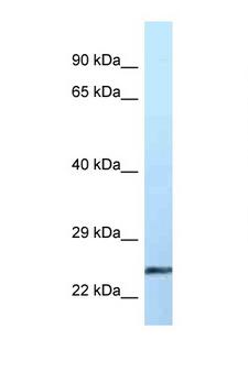 EFNA2 / Ephrin A2 Antibody - EFNA2 / Ephrin A2 antibody Western blot of Placenta lysate. Antibody concentration 1 ug/ml.  This image was taken for the unconjugated form of this product. Other forms have not been tested.