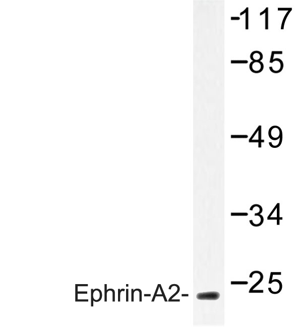 EFNA2 / Ephrin A2 Antibody - Western blot of Ephrin-A2 (N33) pAb in extracts from HeLa cells.