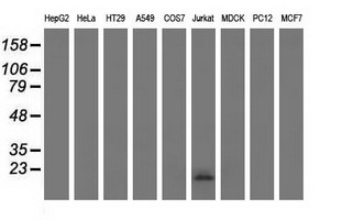EFNA2 / Ephrin A2 Antibody - Western blot analysis of extracts (35ug) from 9 different cell lines by using anti-EFNA2 monoclonal antibody.