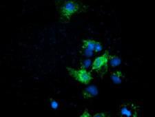 EFNA2 / Ephrin A2 Antibody - Anti-EFNA2 mouse monoclonal antibody  immunofluorescent staining of COS7 cells transiently transfected by pCMV6-ENTRY EFNA2.