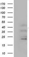 EFNA2 / Ephrin A2 Antibody - HEK293T cells were transfected with the pCMV6-ENTRY control (Left lane) or pCMV6-ENTRY EFNA2 (Right lane) cDNA for 48 hrs and lysed. Equivalent amounts of cell lysates (5 ug per lane) were separated by SDS-PAGE and immunoblotted with anti-EFNA2.