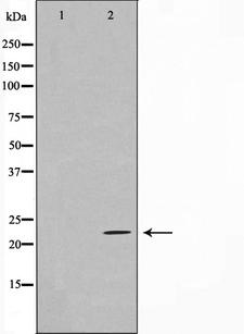 EFNA2 / Ephrin A2 Antibody - Western blot analysis on HeLa cell lysates using EFNA2 antibody. The lane on the left is treated with the antigen-specific peptide.