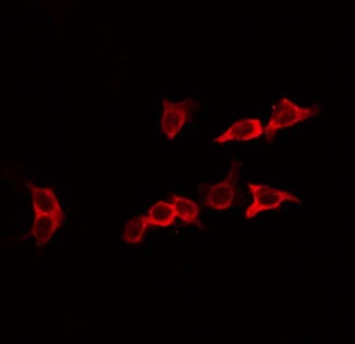 EFNA2 / Ephrin A2 Antibody - Staining HeLa cells by IF/ICC. The samples were fixed with PFA and permeabilized in 0.1% Triton X-100, then blocked in 10% serum for 45 min at 25°C. The primary antibody was diluted at 1:200 and incubated with the sample for 1 hour at 37°C. An Alexa Fluor 594 conjugated goat anti-rabbit IgG (H+L) Ab, diluted at 1/600, was used as the secondary antibody.