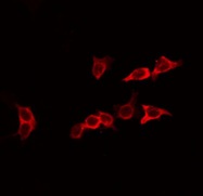 EFNA2 / Ephrin A2 Antibody - Staining HeLa cells by IF/ICC. The samples were fixed with PFA and permeabilized in 0.1% Triton X-100, then blocked in 10% serum for 45 min at 25°C. The primary antibody was diluted at 1:200 and incubated with the sample for 1 hour at 37°C. An Alexa Fluor 594 conjugated goat anti-rabbit IgG (H+L) Ab, diluted at 1/600, was used as the secondary antibody.