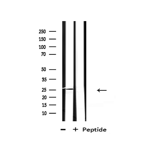 EFNA2 / Ephrin A2 Antibody - Western blot analysis of extracts of mouse brain tissue using EFNA2 antibody.