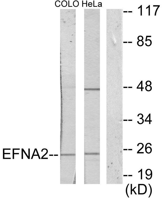 EFNA2 / Ephrin A2 Antibody - Western blot analysis of extracts from COLO205 cells and HeLa cells, using EFNA2 antibody.