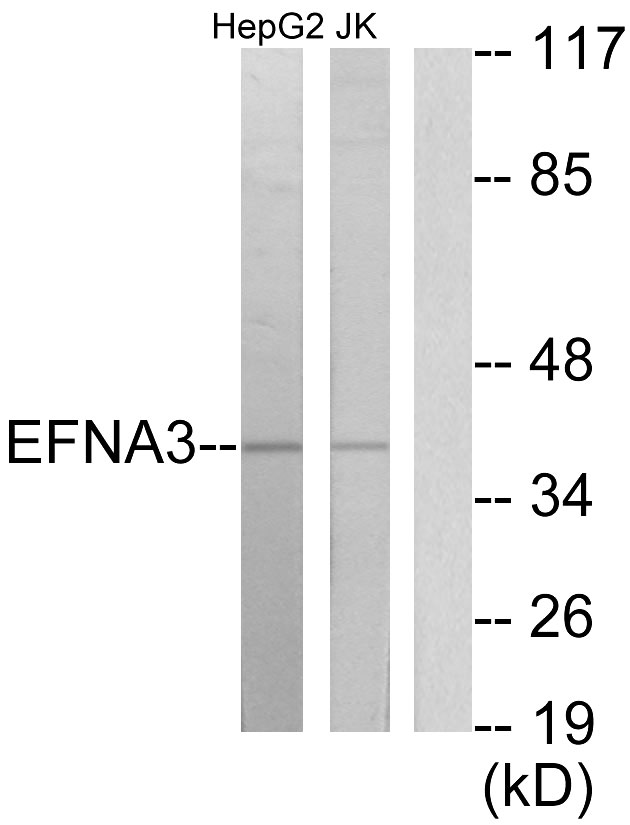 EFNA3 / Ephrin A3 Antibody - Western blot analysis of lysates from HepG2 and Jurkat cells, using EFNA3 Antibody. The lane on the right is blocked with the synthesized peptide.