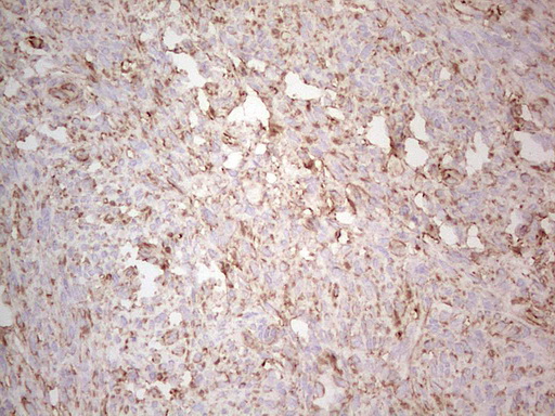 EFNA3 / Ephrin A3 Antibody - Immunohistochemical staining of paraffin-embedded Human endometrium tissue within the normal limits using anti-EFNA3 mouse monoclonal antibody. (Heat-induced epitope retrieval by 1 mM EDTA in 10mM Tris, pH8.5, 120C for 3min,