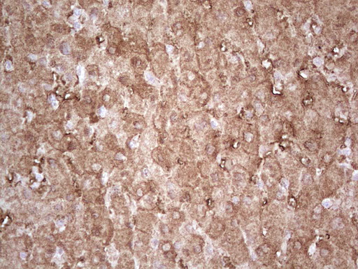 EFNA3 / Ephrin A3 Antibody - Immunohistochemical staining of paraffin-embedded Human liver tissue within the normal limits using anti-EFNA3 mouse monoclonal antibody. (Heat-induced epitope retrieval by 1 mM EDTA in 10mM Tris, pH8.5, 120C for 3min,
