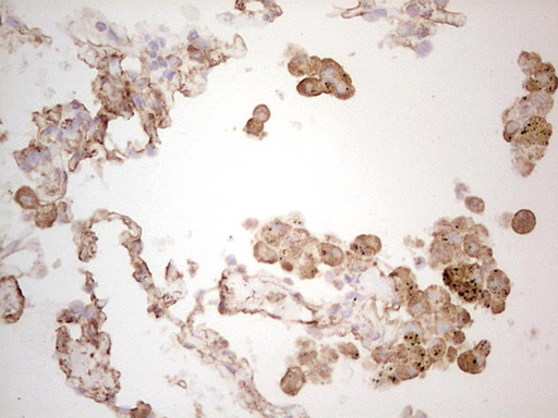 EFNA3 / Ephrin A3 Antibody - Immunohistochemical staining of paraffin-embedded Human lung tissue within the normal limits using anti-EFNA3 mouse monoclonal antibody. (Heat-induced epitope retrieval by 1 mM EDTA in 10mM Tris, pH8.5, 120C for 3min,
