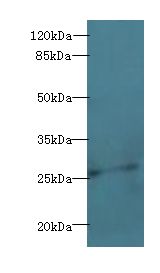 EFNA3 / Ephrin A3 Antibody - Western blot. All lanes: EFNA3 antibody at 2 ug/ml+HepG2 whole cell lysate. Secondary antibody: Goat polyclonal to rabbit at 1:10000 dilution. Predicted band size: 26 kDa. Observed band size: 26 kDa Immunohistochemistry.