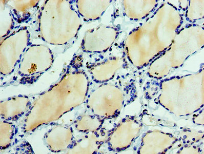 EFNA3 / Ephrin A3 Antibody - Immunohistochemistry of paraffin-embedded human thyroid tissue using EFNA3 Antibody at dilution of 1:100
