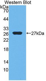 EFNA3 / Ephrin A3 Antibody - Western blot of EFNA3 / Ephrin A3 antibody.