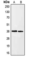 EFNA3 / Ephrin A3 Antibody - Western blot analysis of Ephrin A3 expression in HeLa (A); HepG2 (B) whole cell lysates.
