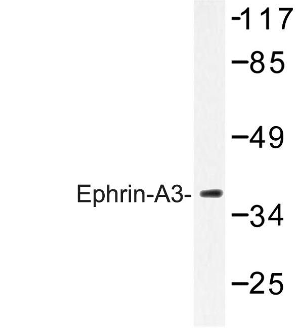 EFNA3 / Ephrin A3 Antibody - Western blot of Ephrin-A3 (E196) pAb in extracts from HepG2 cells.