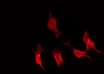 EFNA3 / Ephrin A3 Antibody - Staining HepG2 cells by IF/ICC. The samples were fixed with PFA and permeabilized in 0.1% Triton X-100, then blocked in 10% serum for 45 min at 25°C. The primary antibody was diluted at 1:200 and incubated with the sample for 1 hour at 37°C. An Alexa Fluor 594 conjugated goat anti-rabbit IgG (H+L) Ab, diluted at 1/600, was used as the secondary antibody.