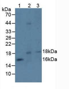 EFNA4 / Ephrin A4 Antibody - Western Blot; Sample: Lane1: Mouse Spleen Tissue; Lane2: Mouse Ovary Tissue; Lane3: Mouse Thymus Tissue.