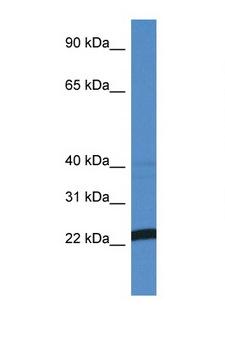 EFNA4 / Ephrin A4 Antibody - EFNA4 / Ephrin A4 antibody Western blot of MCF7 Cell lysate. Antibody concentration 1 ug/ml.  This image was taken for the unconjugated form of this product. Other forms have not been tested.