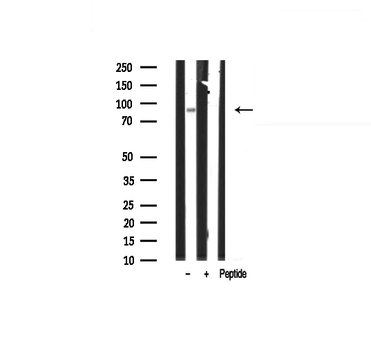 EFNA4 / Ephrin A4 Antibody - Western blot analysis on HepG2 cell lysates using EFNA4 antibody