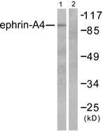 EFNA4 / Ephrin A4 Antibody - Western blot analysis of extracts from HepG2 cells, using Ephrin-A4 antibody.