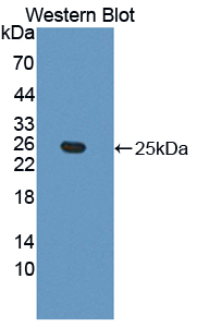 EFNA5 / Ephrin A5 Antibody - Western blot of EFNA5 / Ephrin A5 antibody.