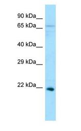 EFNA5 / Ephrin A5 Antibody - EFNA5 / Ephrin A5 antibody Western Blot of HeLa.  This image was taken for the unconjugated form of this product. Other forms have not been tested.