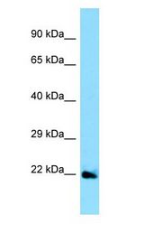 EFNA5 / Ephrin A5 Antibody - EFNA5 / Ephrin A5 antibody Western Blot of HeLa.  This image was taken for the unconjugated form of this product. Other forms have not been tested.