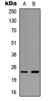 EFNA5 / Ephrin A5 Antibody - Western blot analysis of Ephrin A5 expression in HeLa (A); NIH3T3 (B) whole cell lysates.
