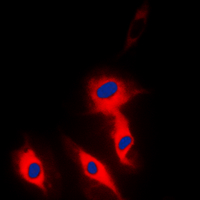 EFNA5 / Ephrin A5 Antibody - Immunofluorescent analysis of Ephrin A5 staining in HeLa cells. Formalin-fixed cells were permeabilized with 0.1% Triton X-100 in TBS for 5-10 minutes and blocked with 3% BSA-PBS for 30 minutes at room temperature. Cells were probed with the primary antibody in 3% BSA-PBS and incubated overnight at 4 deg C in a humidified chamber. Cells were washed with PBST and incubated with a DyLight 594-conjugated secondary antibody (red) in PBS at room temperature in the dark. DAPI was used to stain the cell nuclei (blue).